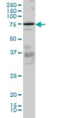 Western Blot: PKC iota Antibody (3A7) [H00005584-M02]