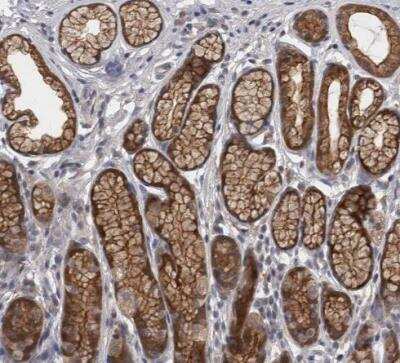 Immunohistochemistry-Paraffin: PKC iota Antibody [NBP1-84959]