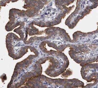 Immunohistochemistry-Paraffin: PKC iota Antibody [NBP1-84959]