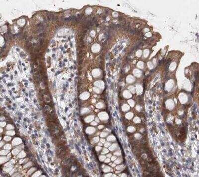 Immunohistochemistry-Paraffin: PKC iota Antibody [NBP1-84959]