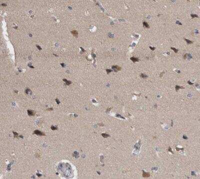 Immunohistochemistry-Paraffin: PKC iota Antibody [NBP1-84959]