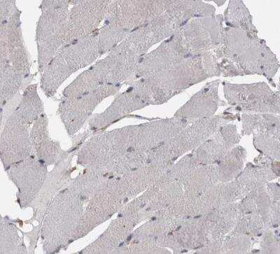Immunohistochemistry-Paraffin: PKC iota Antibody [NBP1-84959]