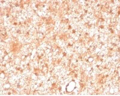 Immunohistochemistry-Paraffin: PKC iota Antibody (PRKCI/4911) [NBP3-13752]