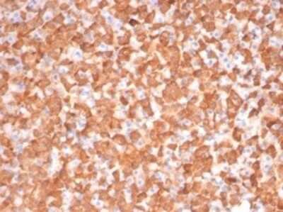 Immunohistochemistry-Paraffin: PKC iota Antibody (PRKCI/4911) [NBP3-13752]
