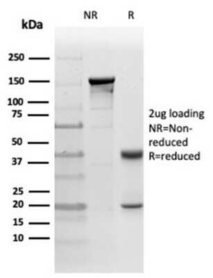 Immunohistochemistry-Paraffin: PKC iota Antibody (PRKCI/4911) [NBP3-13752]