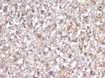 Immunohistochemistry-Paraffin: PKC iota Antibody (PRKCI/4912) [NBP3-13753]