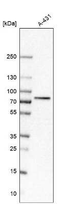 Western Blot: PKC iota Antibody [NBP1-84959]