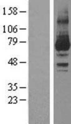 Western Blot: PKC iota Overexpression Lysate [NBL1-14777]