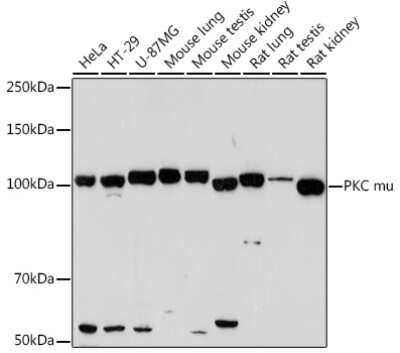 Western Blot: PKC mu Antibody (2A5U1) [NBP3-16130]