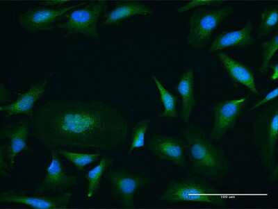 Immunocytochemistry/ Immunofluorescence: PKC mu Antibody [H00005587-B01P]