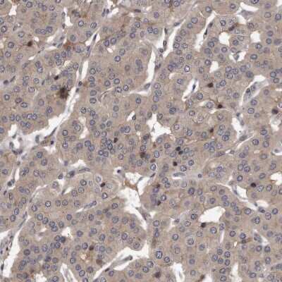 Immunohistochemistry-Paraffin: PKC mu Antibody [NBP1-87789]