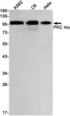 Western Blot: PKC mu Antibody (S05-4J5) [NBP3-14964]