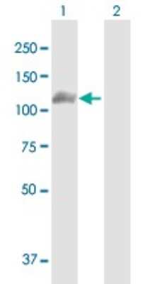 Western Blot: PKC mu Antibody [H00005587-B01P]