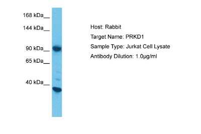 Western Blot: PKC mu Antibody [NBP2-88057]