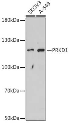 Western Blot: PKC mu AntibodyAzide and BSA Free [NBP2-94000]