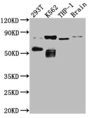 Western Blot: PKC theta Antibody (1B2) [NBP3-15185]