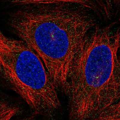 Immunocytochemistry/ Immunofluorescence: PKC theta Antibody [NBP2-57727]