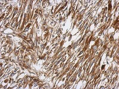 Immunohistochemistry-Paraffin: PKC theta Antibody [NBP2-19851]