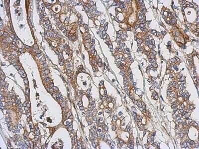 Immunohistochemistry-Paraffin: PKC theta Antibody [NBP2-19851]