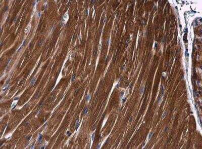 Immunohistochemistry-Paraffin: PKC theta Antibody [NBP2-19851]