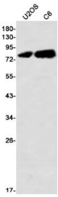 Western Blot: PKC theta Antibody (S05-5I4) [NBP3-19907]