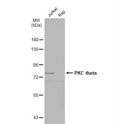 Western Blot: PKC theta Antibody [NBP2-19851]