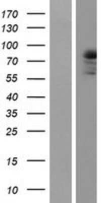 Western Blot: PKC theta Overexpression Lysate [NBP2-10420]