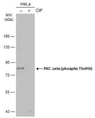 Western Blot: PKC zeta [p Thr410] Antibody [NBP3-13313]