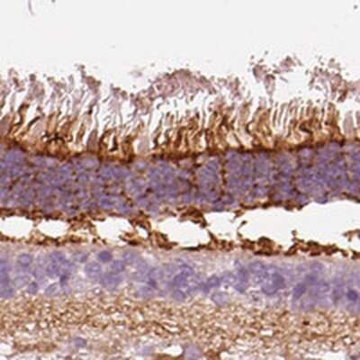 Immunohistochemistry-Paraffin: PKC zeta Antibody [NBP1-87270]