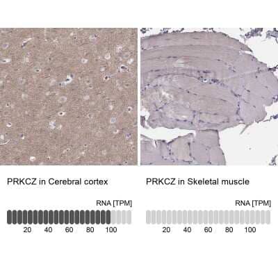 Immunohistochemistry-Paraffin: PKC zeta Antibody [NBP1-87270]