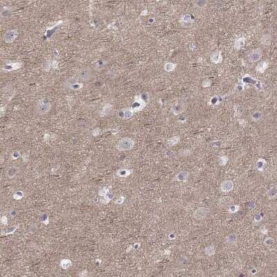 Immunohistochemistry-Paraffin: PKC zeta Antibody [NBP1-87270]