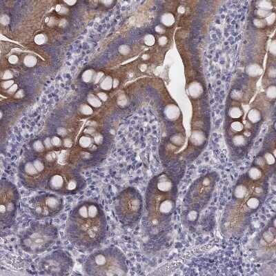 Immunohistochemistry-Paraffin: PKC zeta Antibody [NBP1-87270]