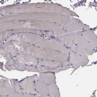 Immunohistochemistry-Paraffin: PKC zeta Antibody [NBP1-87270]