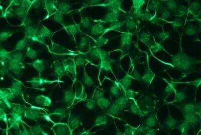 Immunocytochemistry/ Immunofluorescence: PKC zeta Antibody (R14-K) [NBP1-30127]