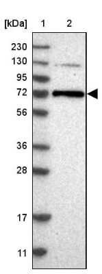 Western Blot: PKC zeta Antibody [NBP1-87270]