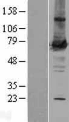 Western Blot: PKC zeta Overexpression Lysate [NBL1-14778]