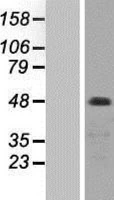 Western Blot: PKC zeta Overexpression Lysate [NBP2-11050]