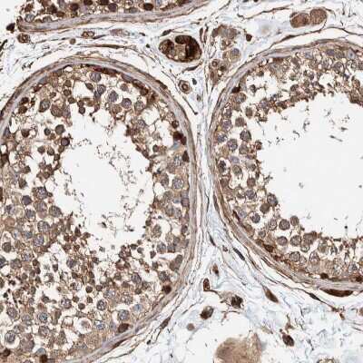 Immunohistochemistry-Paraffin: PKD1L1 Antibody [NBP1-87219]