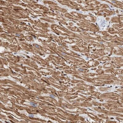 Immunohistochemistry-Paraffin: PKD1L1 Antibody [NBP1-87219]