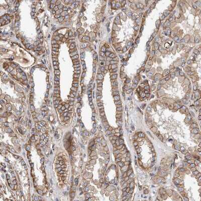 Immunohistochemistry-Paraffin: PKD1L1 Antibody [NBP1-87219]