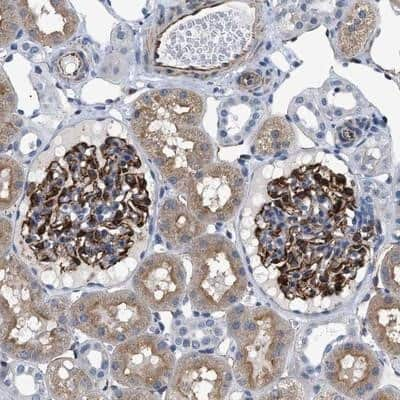 Immunohistochemistry-Paraffin: PKD1L1 Antibody [NBP1-87220]