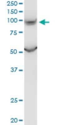 Western Blot: PKD2L1 Antibody (4F9) [H00009033-M01]