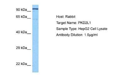 Western Blot: PKD2L1 Antibody [NBP2-86748]