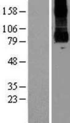 Western Blot: PKD2L1 Overexpression Lysate [NBP2-07091]