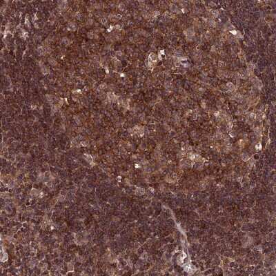 Immunohistochemistry: PKD2L2 Antibody [NBP2-47332]