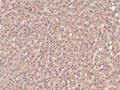 Immunohistochemistry-Paraffin: PKD2L2 Antibody [NBP2-97274]