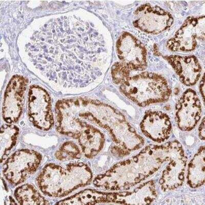 Immunohistochemistry: PKHD1 Antibody [NBP1-89003]