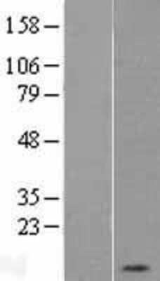 Western Blot: PKI-alpha Overexpression Lysate [NBP2-04886]