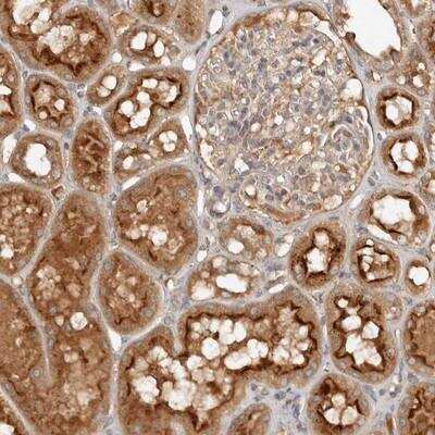 Immunohistochemistry-Paraffin: PKI-beta Antibody [NBP1-80880]