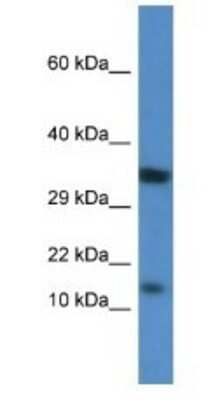 Western Blot: PKI-beta Antibody [NBP1-74255]